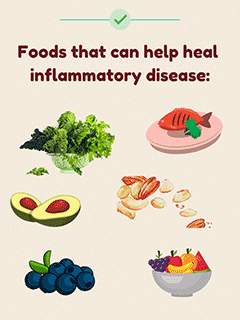 Illustration of Foods That Reduce Inflammation